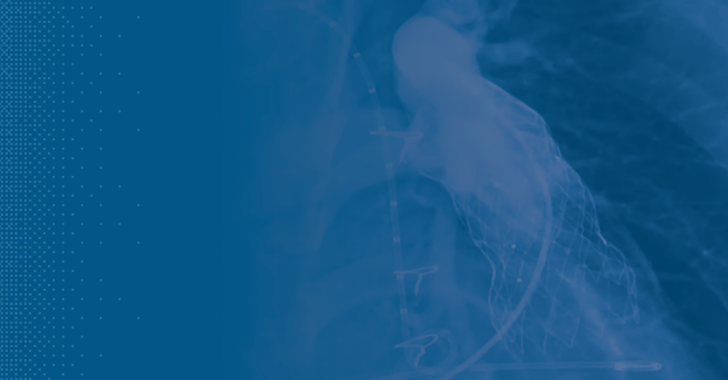 Valvular Interventions Webinars Csi Education Valvular Interventions Webinars Csi Education